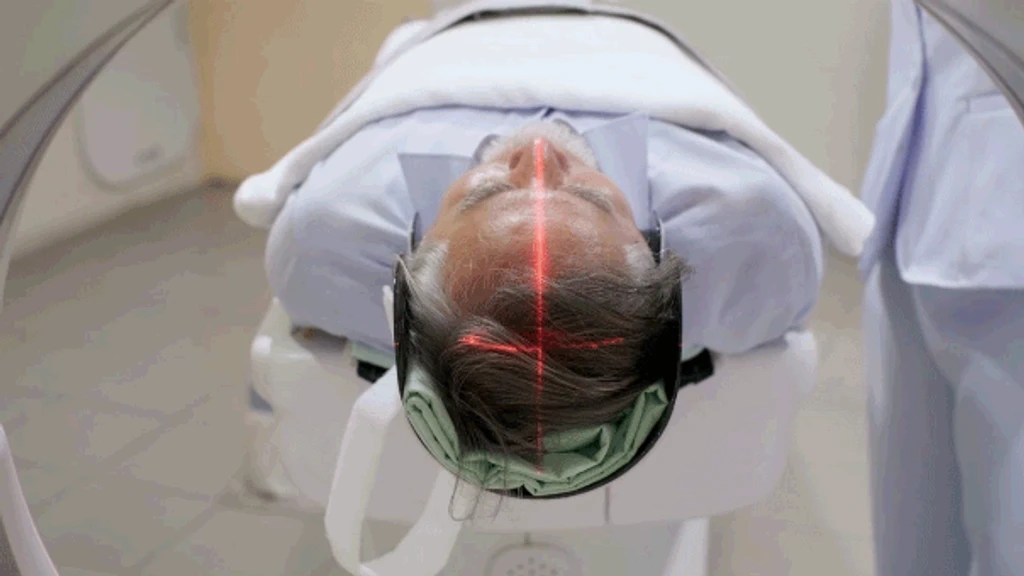 Longevity Gene APOE2 Shields Brain from Alzheimer's by Boosting DNA Repair