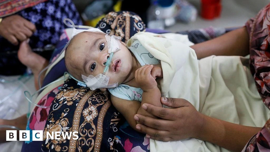 Bangladesh Launches Emergency Measles Vaccination After 100 Deaths
