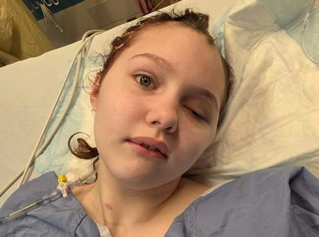 Maya Gebala's Skull Repair Surgery Successful, Father Reports