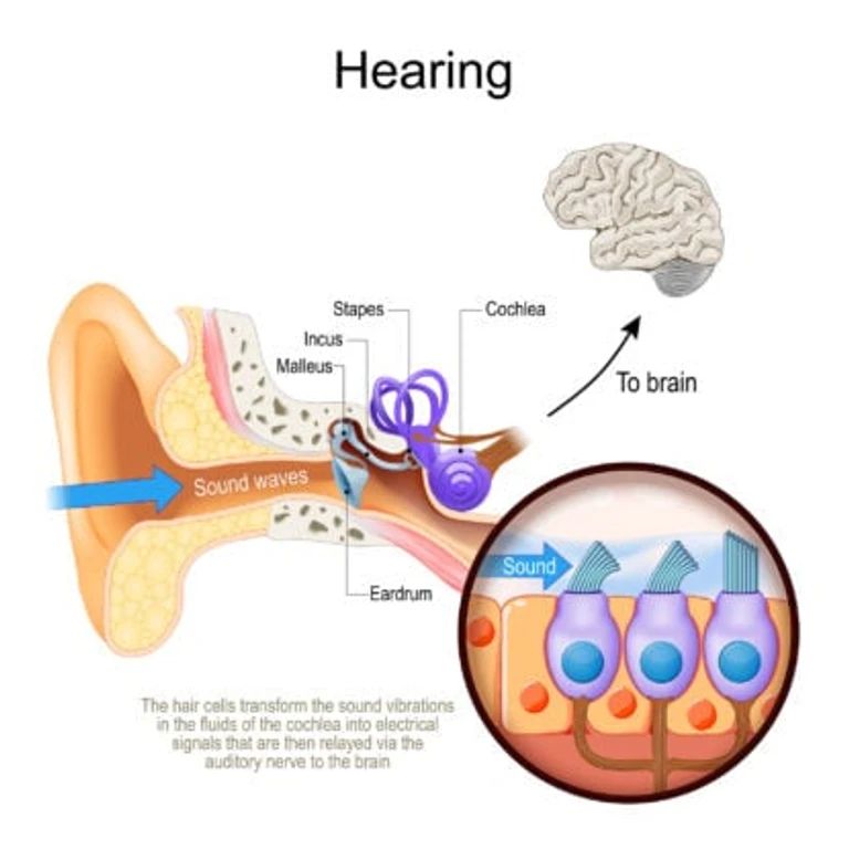 - Figure 2 - 