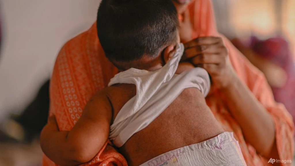 Measles Outbreak in Bangladesh Kills Over 500 Children