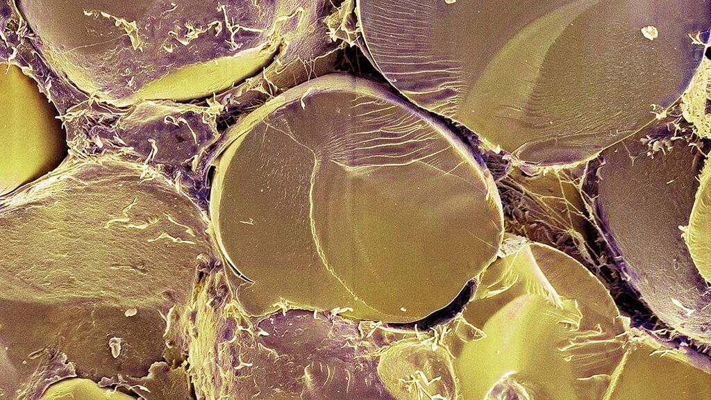 Scientists Identify Crucial Protein Switch for Human Fat Metabolism