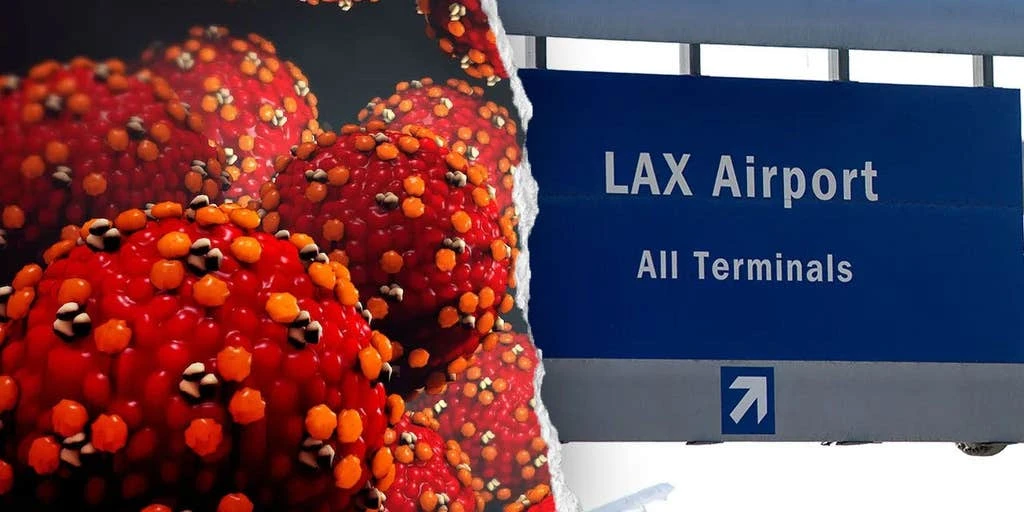 Measles Exposure Alert Issued for LAX Terminal and Airport Hotel