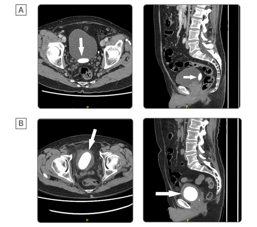- Figure 1 - 