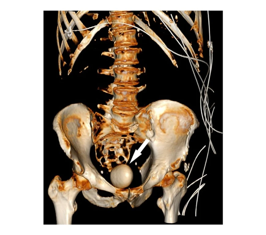 - Figure 2 - 