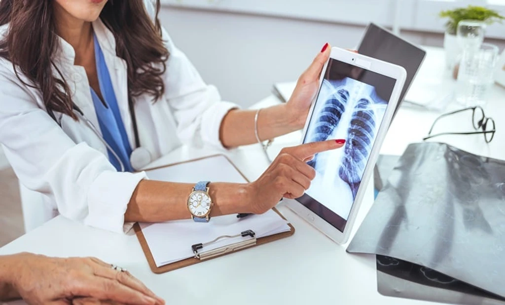 Nerandomilast Shows Promise Against Autoimmune Lung Disease