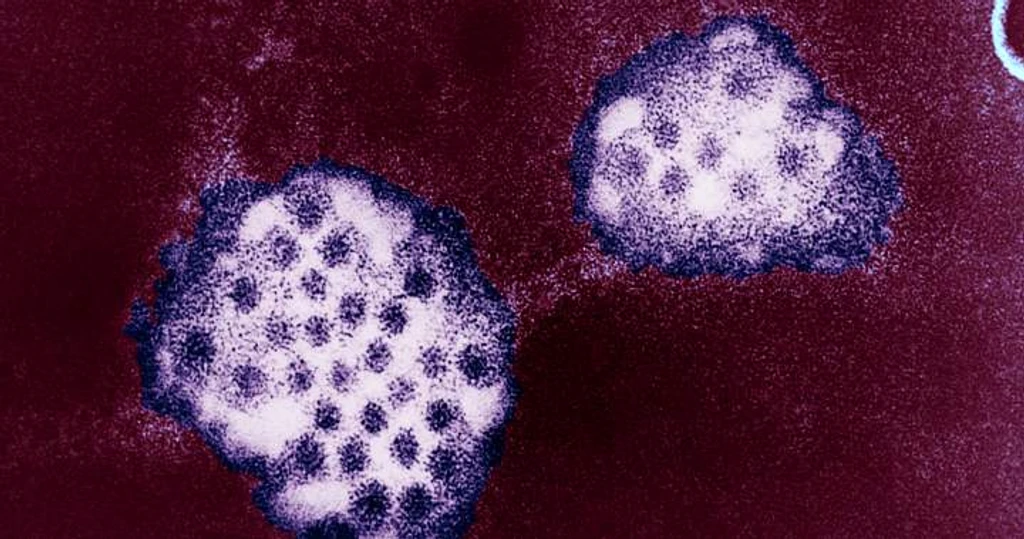 Norovirus Cases Rising in Ontario: Health Unit Issues Alert
