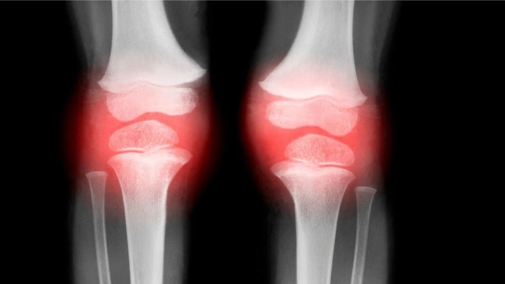 Single Injection Reverses Osteoarthritis in Animal Study