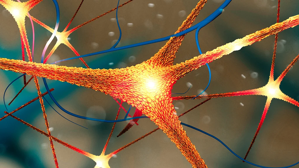 Parkinson's Protein Linked to Faster Alzheimer's Progression in Women