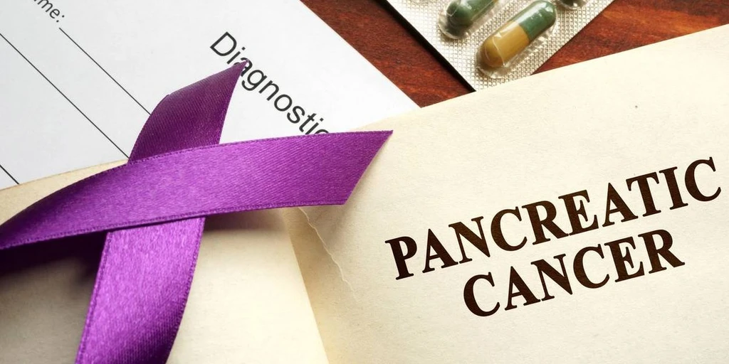 Pancreatic Cancer: The Silent Threat and What You Need to Know
