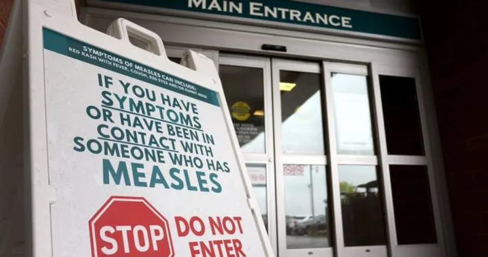 Public Health Alerts Kingston Residents to Potential Measles Exposures