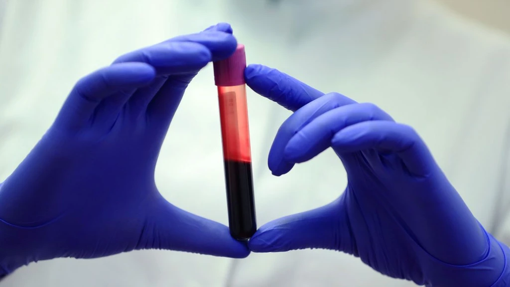 Study: Rising CO2 Levels May Be Altering Human Blood Chemistry