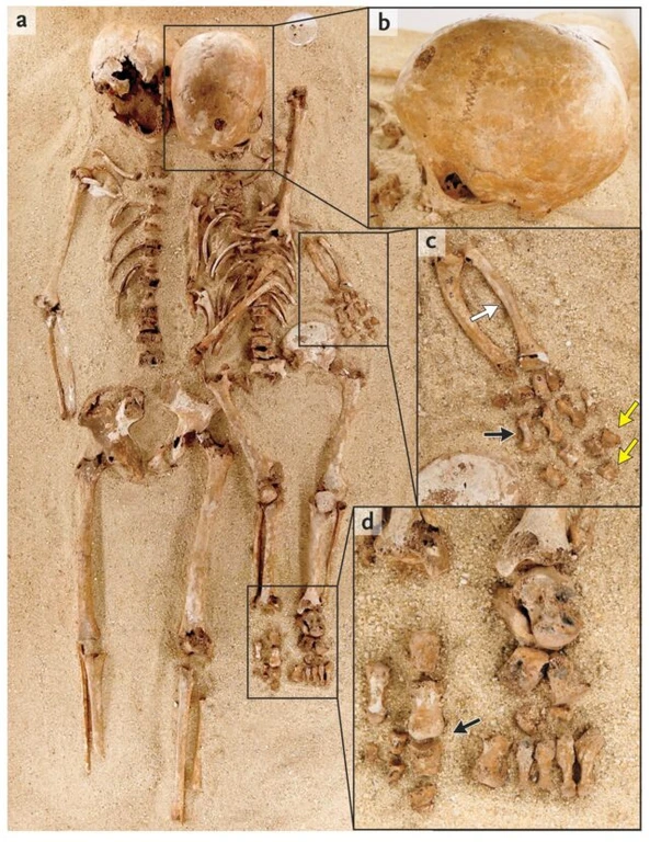 - Figure 1 - 