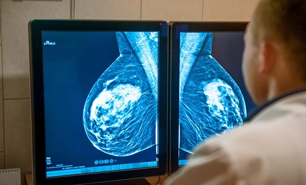 MRI-Guided Sonography Boosts Breast Lesion Detection by 91%