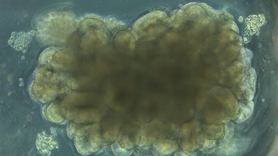 Lab-Grown Mini-Brains Trained to Solve Engineering Challenges