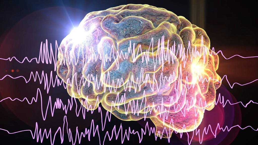 Sleep After Seizures May 'Memorize' Epilepsy, New Study Reveals