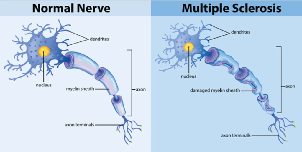 - Figure 1 - 