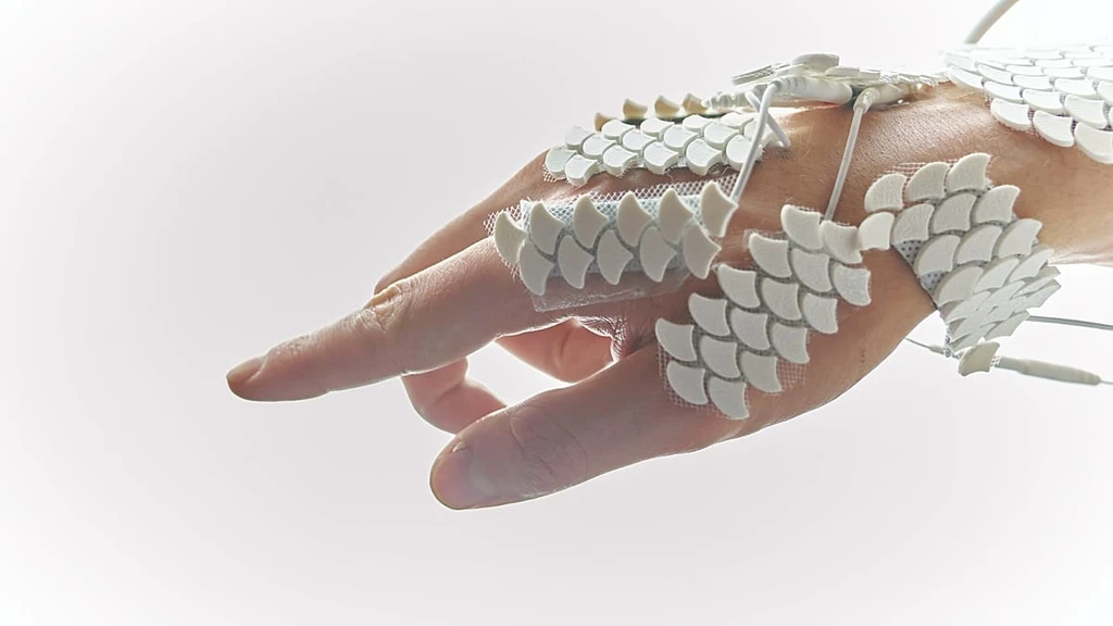 MIT Students Build AI System That Controls Hand Movements