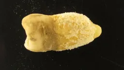 Ancient Bolivian Mummy Tooth Reshapes Scarlet Fever Origins