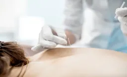 Acupuncture Protocols Under Review for Chemotherapy Nausea in Breast Cancer Patients
