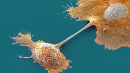 Experimental Drug Elraglusib Doubles Pancreatic Cancer Survival Rate