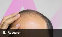 Severe Hair Loss Linked to Sexual Dysfunction in Clinical Study