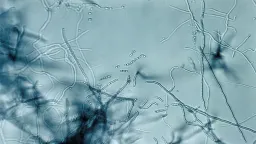 Megacluster Discovery Offers New Antibiotic Strategy Against Superbugs