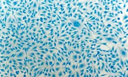 HIV-Positive Women Face Rising Cervical Cancer Risk with Age