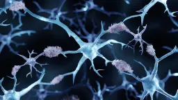 Copper Compound Cu(ATSM) Reduces Alzheimer's Proteins in Mice