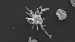 Ancient Microbe's Oxygen Use Offers Clue to Complex Life's Origin