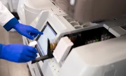 Rapid Test Identifies Life-Threatening Lung Syndrome Subtypes