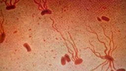 Ancient Killer Typhoid Fever Gains Dangerous Antibiotic Resistance