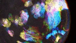 Fruit Fly Study Reveals Clue to Brain Cancer's Mysterious Origins