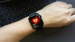 Apple Watch Revolutionizes Atrial Fibrillation Detection in High-Risk Seniors