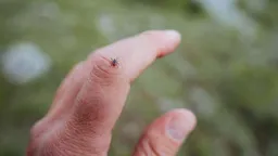 Avoid These 5 Common Tick Check Mistakes