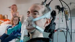 Brain Implant Restores Speech for ALS Patient in Historic Clinical Trial