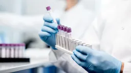 Singapore’s Discarded Blood Samples Could Power Medical Breakthroughs