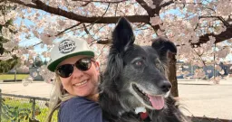 Living with Neurofibromatosis: One Woman's Fight Against Stigma
