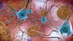Blood Test May Flag Alzheimer's Risk Years Before Symptoms