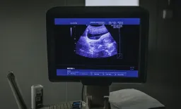 COVID-19 Linked to Measurable Shifts in Fetal Growth