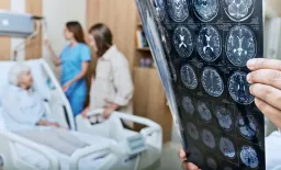 Prior Stroke Significantly Raises Mortality Risk After Heart Attack