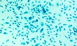 Enhancing Prostate Cancer Detection with Circulating Tumor Cells