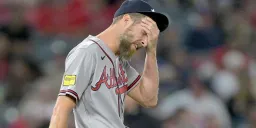 Chris Sale's Anger Flip: Braves Star Slams Ball Into Head