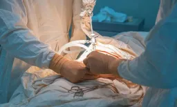 Gastric Bypass: Long-Term Cancer Risk in Excluded Stomach
