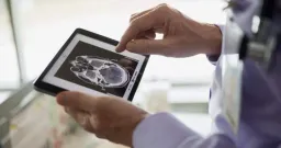 Alberta's Plan to Fast-Track Medical Tests Without Referrals Sparks Doctor Concerns