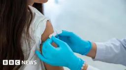 Australia Reports First Diphtheria Death in Years as Outbreak Worsens