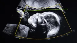 DNA's Unsettling Twist: When Birth Doesn't Match Biology