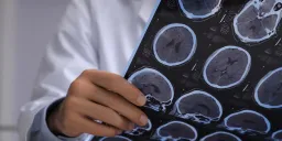 Spanish Man’s Suspected Brain Cancer Revealed as Live Parasitic Tapeworms
