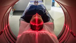 Deep Sleep: A Powerful Defense Against Alzheimer's Memory Decline
