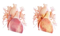 Epicardial Fat Index on MRI Predicts Heart Failure Risk